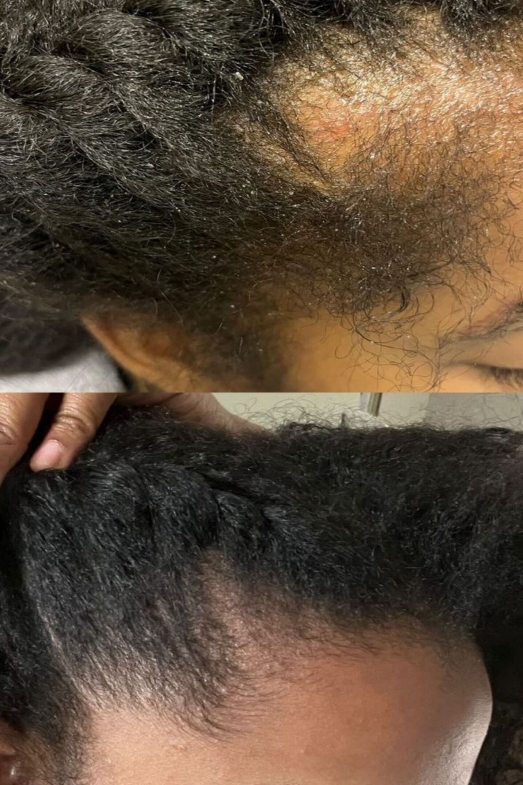 Pour réparer mon cuir chevelu