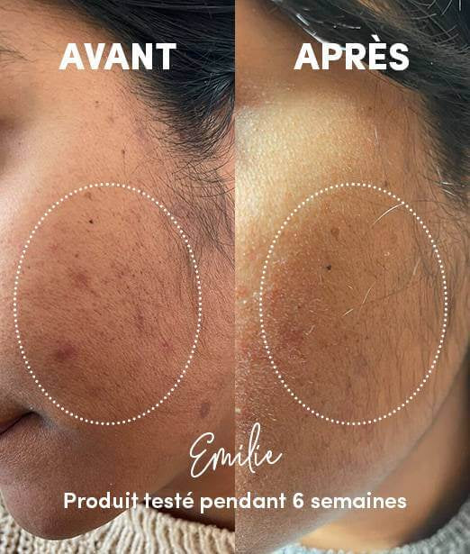 Nettoyant visage anti-imperfections en poudre